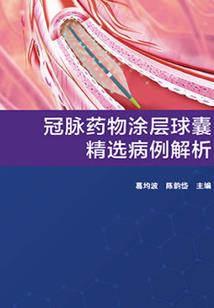 结算会计和应付会计分录